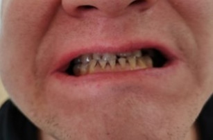 .